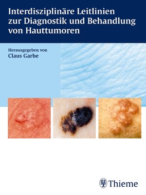 cover image of Interdisziplinäre Leitlinien zur Diagnostik und Behandlung von Hauttumoren